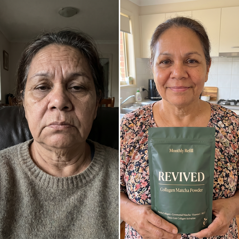 Skin headed south — before and after